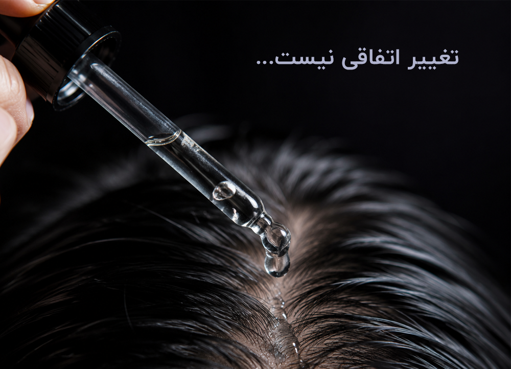 تغییر اتفاقی نیست