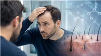 کنترل و رفع ریزش مو و افزایش و تقویت رویش مو با رژیم غذایی